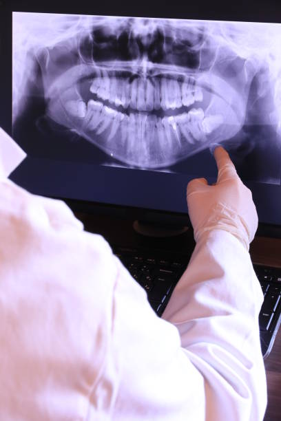 Best Emergency Dental Care for Sports Injuries in Forest, VA